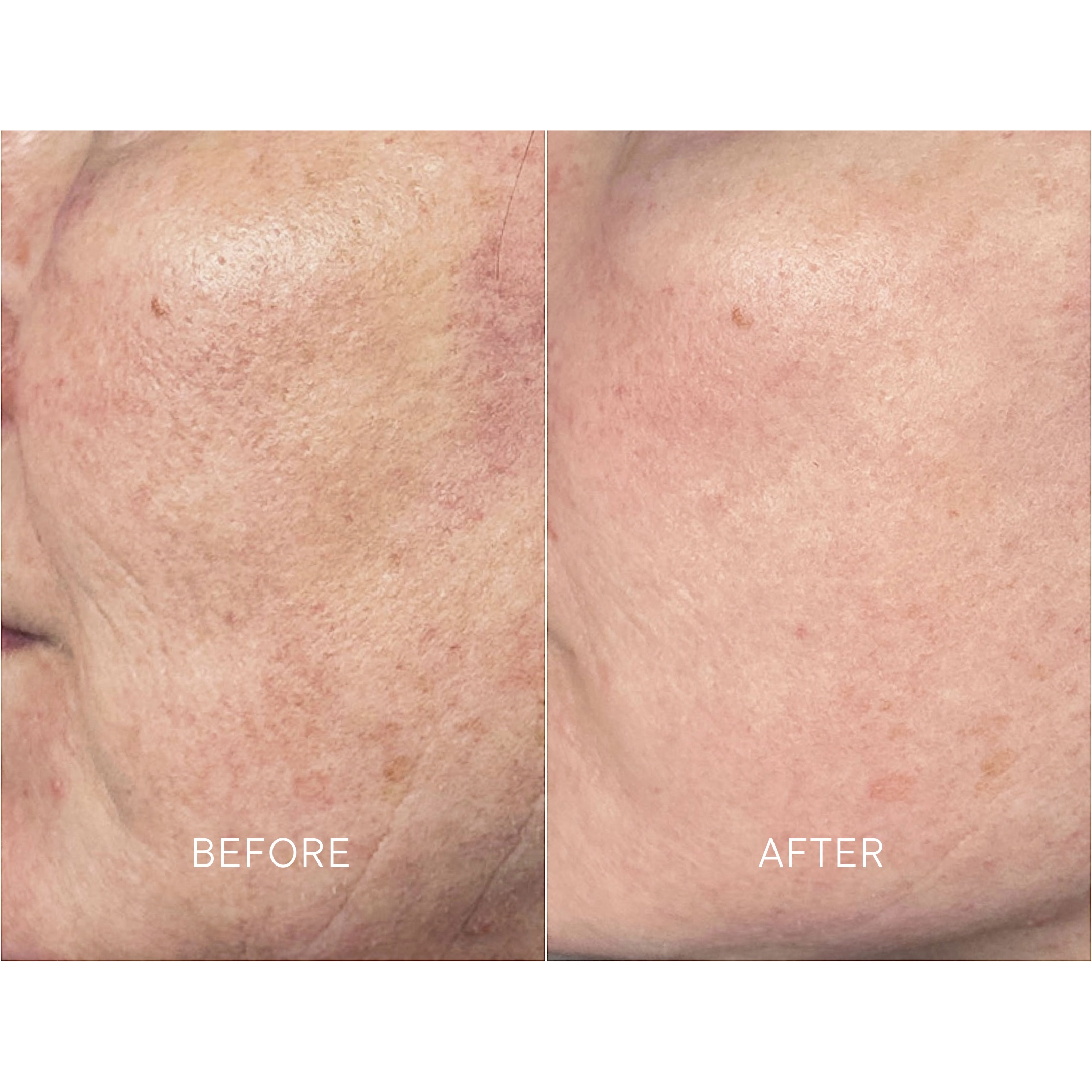 Artisa skincare before and after · before and after composite