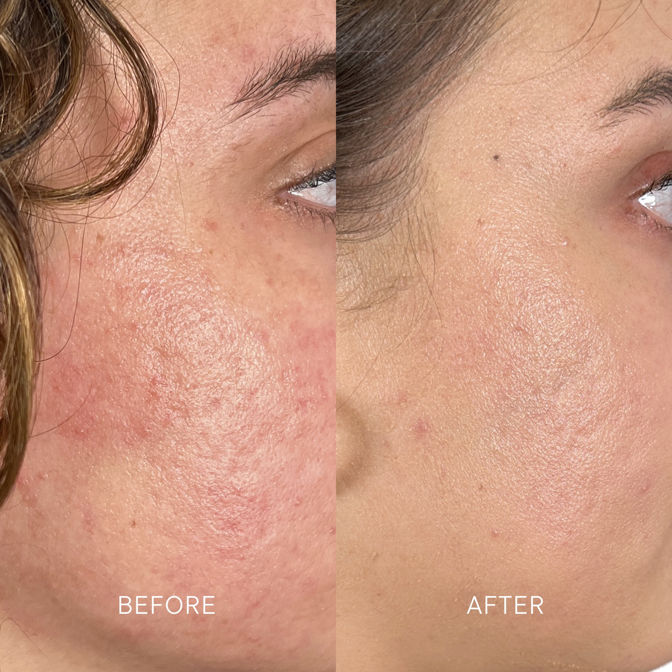 Artisa skincare before and after · before and after composite