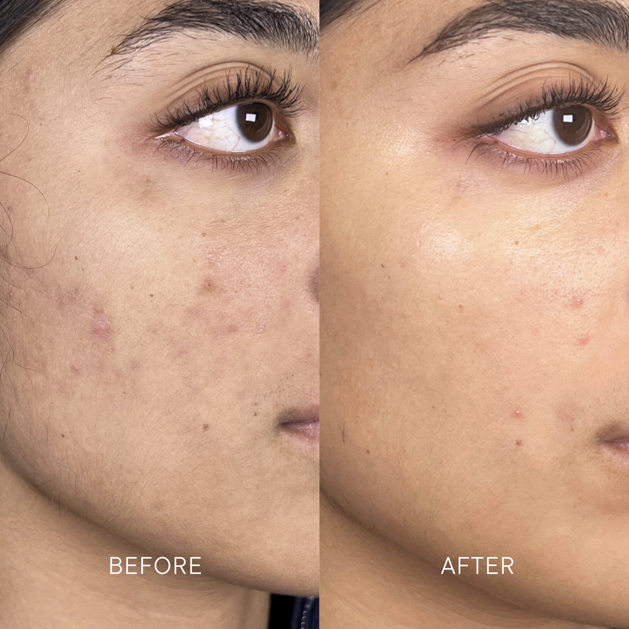 Artisa skincare before and after · before and after composite